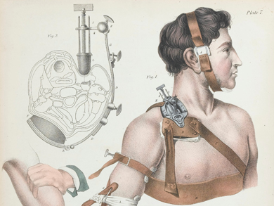 'Operative surgery.' Copyright Wellcome Library, London. CC BY 4.0